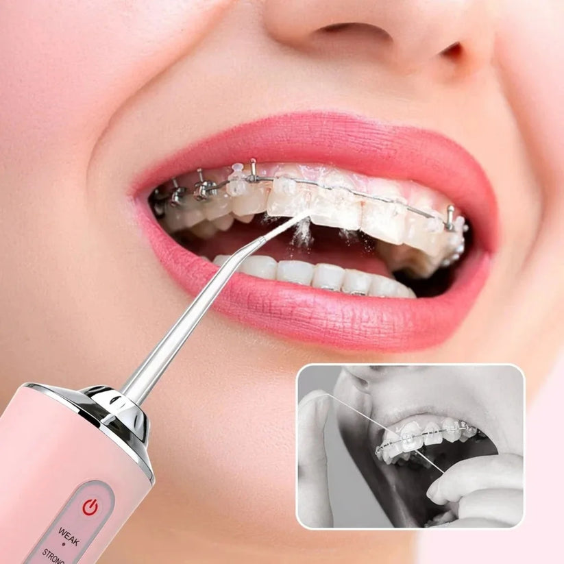 Irrigador Bucal Limpiador Dientes, Garganta y Boca  MEXIMATKET 🛒